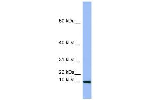 Image no. 2 for anti-Semenogelin I (SEMG1) (Middle Region) antibody (ABIN2777137)