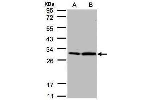WB Image Sample(30 μg of whole cell lysate) A:Hep G2, B:MOLT4, 12% SDS PAGE antibody diluted at 1:2000