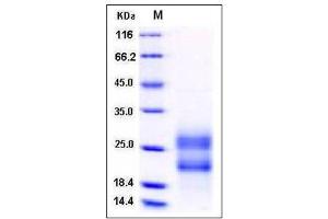 Image no. 1 for R-Spondin 3 (RSPO3) (AA 1-146) (Active) protein (His tag) (ABIN2004051)