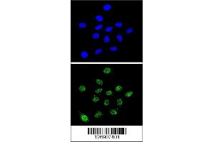 Immunofluorescence (IF) image for anti-Dyskeratosis Congenita 1, Dyskerin (DKC1) antibody (ABIN2158558)