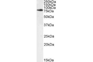 Image no. 2 for anti-Numb Homolog (NUMB) (C-Term) antibody (ABIN184679)