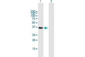 Image no. 1 for anti-Survival of Motor Neuron 2, Centromeric (SMN2) (AA 1-294) antibody (ABIN948479)