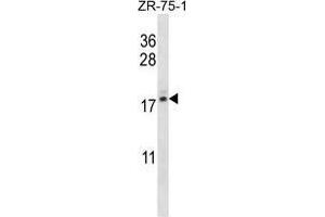 Image no. 1 for anti-Transition Protein 2 (During Histone To Protamine Replacement) (TNP2) (AA 95-124), (C-Term) antibody (ABIN955284)