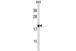 Image no. 1 for anti-ER Membrane Protein Complex Subunit 4 (EMC4) (AA 33-62), (N-Term) antibody (ABIN955262)
