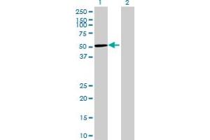 Western Blot analysis of GRINL1A expression in transfected 293T cell line by GRINL1A MaxPab polyclonal antibody.