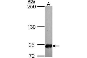 Image no. 1 for anti-Scm-Like with Four Mbt Domains 1 (SFMBT1) (N-Term) antibody (ABIN2857005)