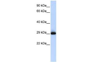 SUSD3 anticorps  (N-Term)