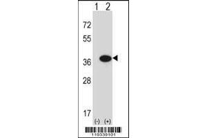 Image no. 1 for anti-Guanosine Monophosphate Reductase (GMPR) (AA 238-267), (C-Term) antibody (ABIN656814)