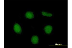 Image no. 2 for anti-Neuroepithelial Cell Transforming 1 (NET1) (AA 1-542) antibody (ABIN1327531)