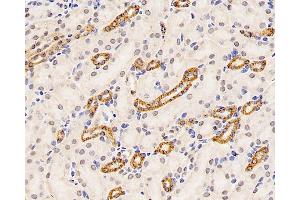 Immunohistochemistry analysis of paraffin-embedded mouse kidney using Mineralocorticoid receptor Polyclonal Antibody at dilution of 1:300.