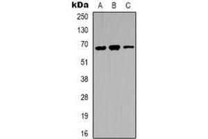 Image no. 3 for anti-Interleukin-1 Receptor-Associated Kinase 3 (IRAK3) (C-Term) antibody (ABIN2801254)