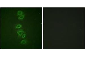 Immunofluorescence analysis of A549 cells, using PP2A-alpha (Phospho-Tyr307) Antibody.