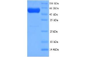 Image no. 1 for Septin 7 (SEPT7) (AA 2-437) protein (His tag) (ABIN5714334)