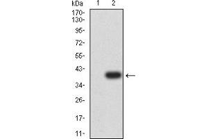 Image no. 3 for anti-Hepatitis A Virus Cellular Receptor 2 (TIM 3) (AA 229-410) antibody (ABIN5684060)