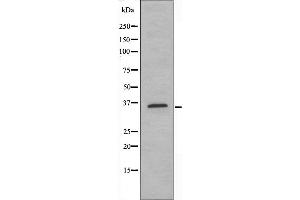 Image no. 1 for anti-Sex Determining Region Y (SRY) antibody (ABIN6257506)