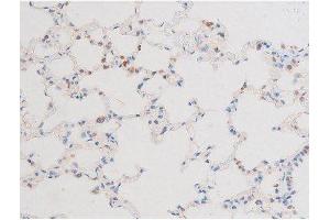 Image no. 6 for anti-Dynamin 1 (DNM1) (pSer774) antibody (ABIN6256419)