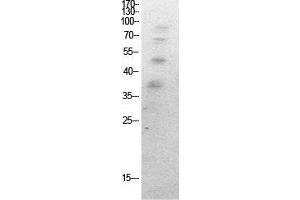 Image no. 2 for anti-Ubiquitin (Ubiquitin) (acLys27) antibody (ABIN3181496)