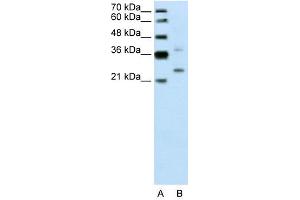 Image no. 2 for anti-Defective in Cullin Neddylation 1, Domain Containing 1 (DCUN1D1) (N-Term) antibody (ABIN2775480)