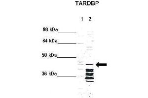 Image no. 2 for anti-TAR DNA Binding Protein (TARDBP) (N-Term) antibody (ABIN2776487)