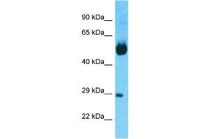 Image no. 1 for anti-Nuclear Receptor Subfamily 1, Group H, Member 4 (NR1H4) (N-Term) antibody (ABIN5514777)