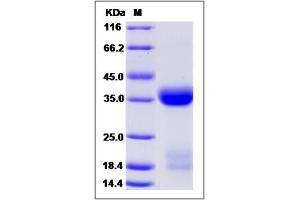Image no. 1 for Kallikrein 1 (KLK1) (AA 1-261) (Active) protein (His tag) (ABIN3216408)