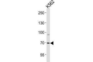 Image no. 2 for anti-Forkhead Box K1 (Foxk1) antibody (ABIN3004358)