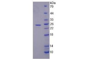 Image no. 1 for Secreted Phosphoprotein 2 (SPP2) (AA 30-211) protein (His tag) (ABIN6237834)