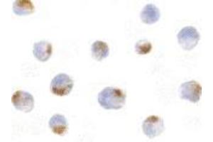 Image no. 1 for anti-Apoptotic Chromatin Condensation Inducer 1 (ACIN1) (Intermediate Domain) antibody (ABIN499201)
