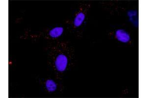 Proximity Ligation Assay (PLA) image for FLT1 & CRKL Protein Protein Interaction Antibody Pair (ABIN1340156)