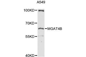 Image no. 1 for anti-Mannosyl (Alpha-1,3-)-Glycoprotein beta-1,4-N-Acetylglucosaminyltransferase, Isozyme B (MGAT4B) antibody (ABIN6292737)