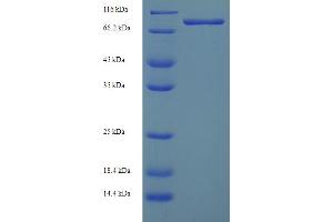 Image no. 1 for Ganglioside-Induced Differentiation-Associated-Protein 2 (GDAP2) (AA 1-496), (full length) protein (His-SUMO Tag) (ABIN5711813)