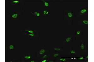Immunofluorescence of purified MaxPab antibody to ABHD11 on HeLa cell.