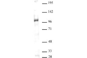 Image no. 1 for anti-K(lysine) Acetyltransferase 2A (KAT2A) (N-Term) antibody (ABIN6972246)