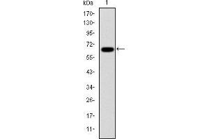 Image no. 6 for anti-Proteasome (Prosome, Macropain) Subunit, beta Type, 8 (Large Multifunctional Peptidase 7) (PSMB8) antibody (ABIN969371)