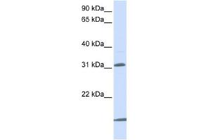 Image no. 1 for anti-Solute Carrier Family 25 (Mitochondrial Carrier, Oxoglutarate Carrier), Member 11 (SLC25A11) (N-Term) antibody (ABIN2781591)