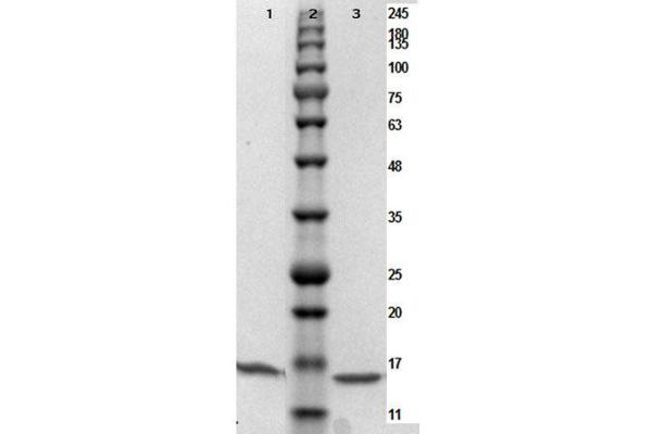 Poly (ADP-Ribose) Polymerase 1 (PARP1) (N-Term) protein