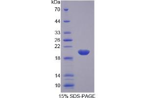 Image no. 3 for Arginyl-tRNA Synthetase (RARS) ELISA Kit (ABIN6720500)