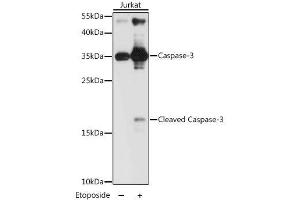 Image no. 4 for anti-Caspase 3 (CASP3) antibody (ABIN3023067)