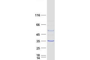 Image no. 1 for RAB40B, Member RAS Oncogene Family (RAB40B) protein (Myc-DYKDDDDK Tag) (ABIN2730356)