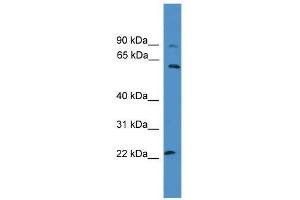 Image no. 1 for anti-Potassium Voltage-Gated Channel, Delayed-Rectifier, Subfamily S, Member 1 (KCNS1) (N-Term) antibody (ABIN927523)