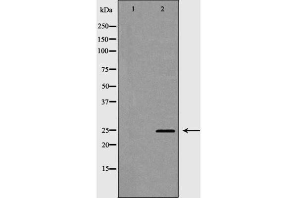 anti-C-Type Lectin Domain Family 4, Member D (CLEC4D) (Internal Region) antibody