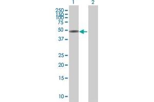 Image no. 1 for anti-Zinc Finger and BTB Domain Containing 25 (ZBTB25) (AA 1-435) antibody (ABIN521523)