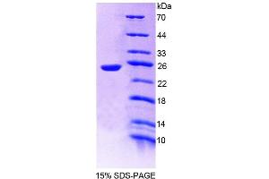 Image no. 1 for Protein Tyrosine Phosphatase, Receptor Type, U (PTPRU) (AA 1263-1446) protein (His tag) (ABIN6239277)