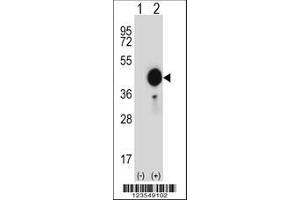 Image no. 3 for anti-Fc Fragment of IgG, Low Affinity IIa, Receptor (CD32) (FCGR2A) (AA 255-282), (C-Term) antibody (ABIN652864)
