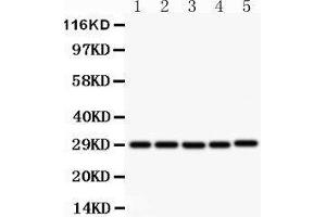 Image no. 2 for anti-CD40 Ligand (CD40LG) (AA 47-65), (N-Term) antibody (ABIN3044319)