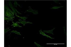 Image no. 3 for anti-Angiotensin I Converting Enzyme (Peptidyl-Dipeptidase A) 1 (ACE) (AA 592-701) antibody (ABIN514909)