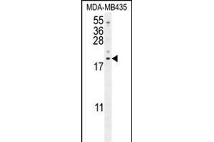 LYRM4 antibody  (AA 43-69)