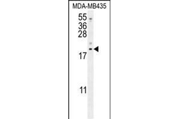 LYRM4 antibody  (AA 43-69)