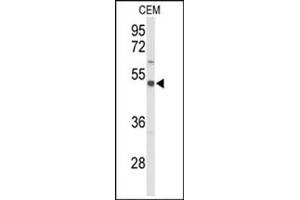 Image no. 2 for anti-Solute Carrier Family 39 (Zinc Transporter), Member 8 (SLC39A8) (AA 225-254), (Middle Region) antibody (ABIN955673)