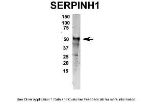 Image no. 2 for anti-serpin Peptidase Inhibitor, Clade H (Heat Shock Protein 47), Member 1, (Collagen Binding Protein 1) (SERPINH1) (C-Term) antibody (ABIN2792207)